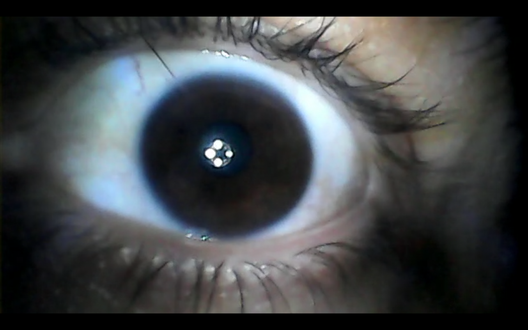 The video still shows a close-up of an eye that is staring directly into the camera. The pupil reflects light source.